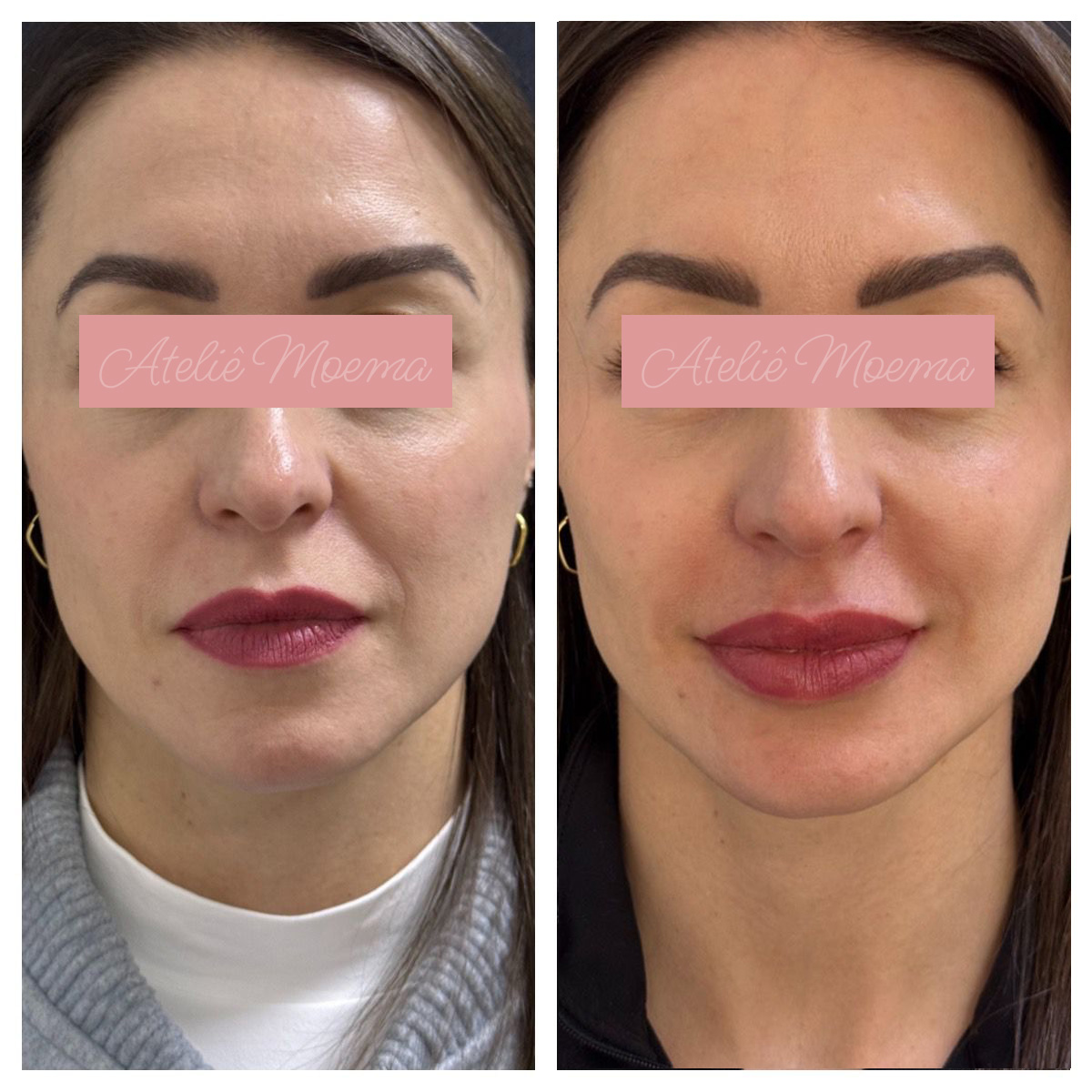 Antes-e-Depois-1.jpg