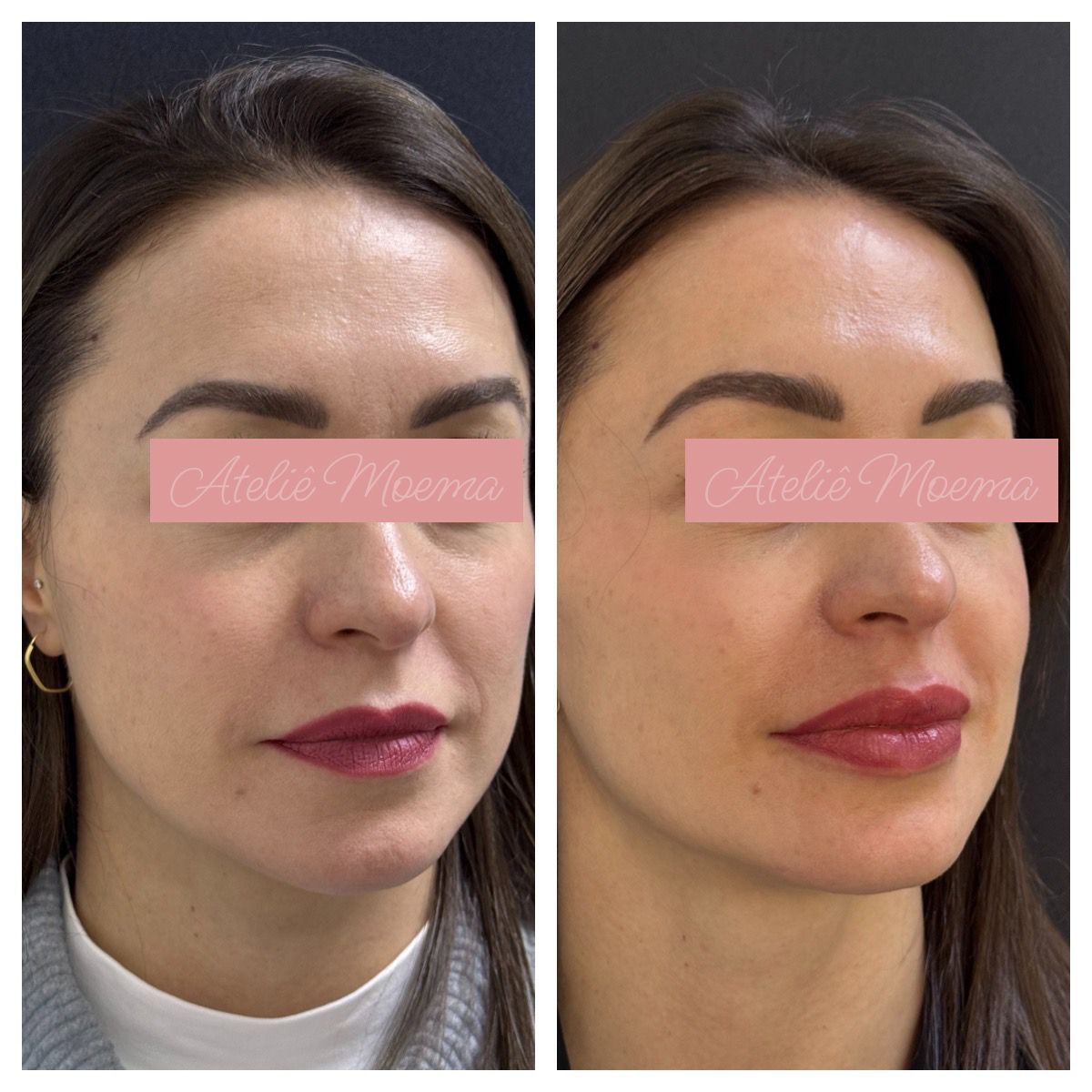 Antes-e-Depois-2.jpg