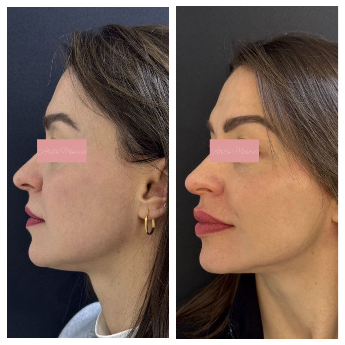 Antes-e-Depois-3.jpg