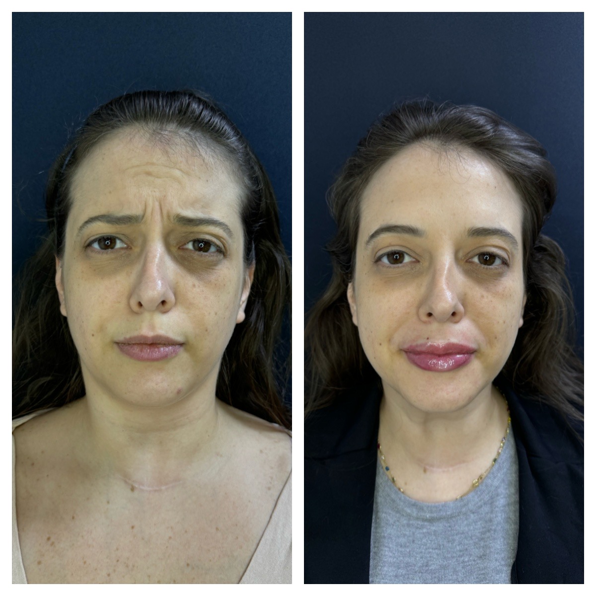 Processed with MOLDIV