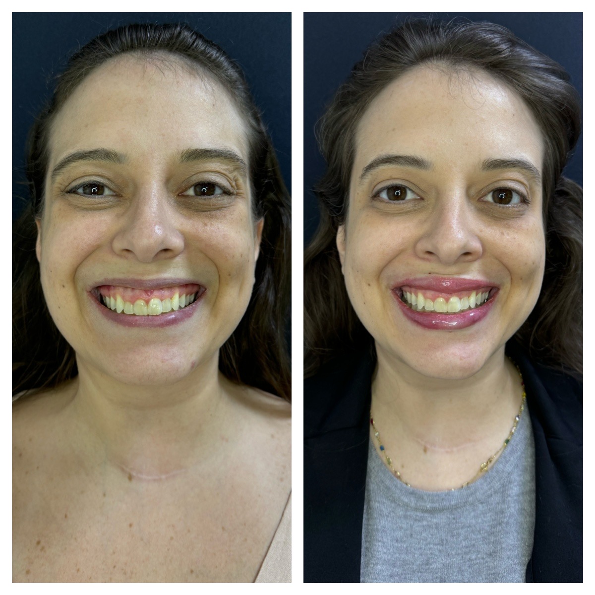 Processed with MOLDIV