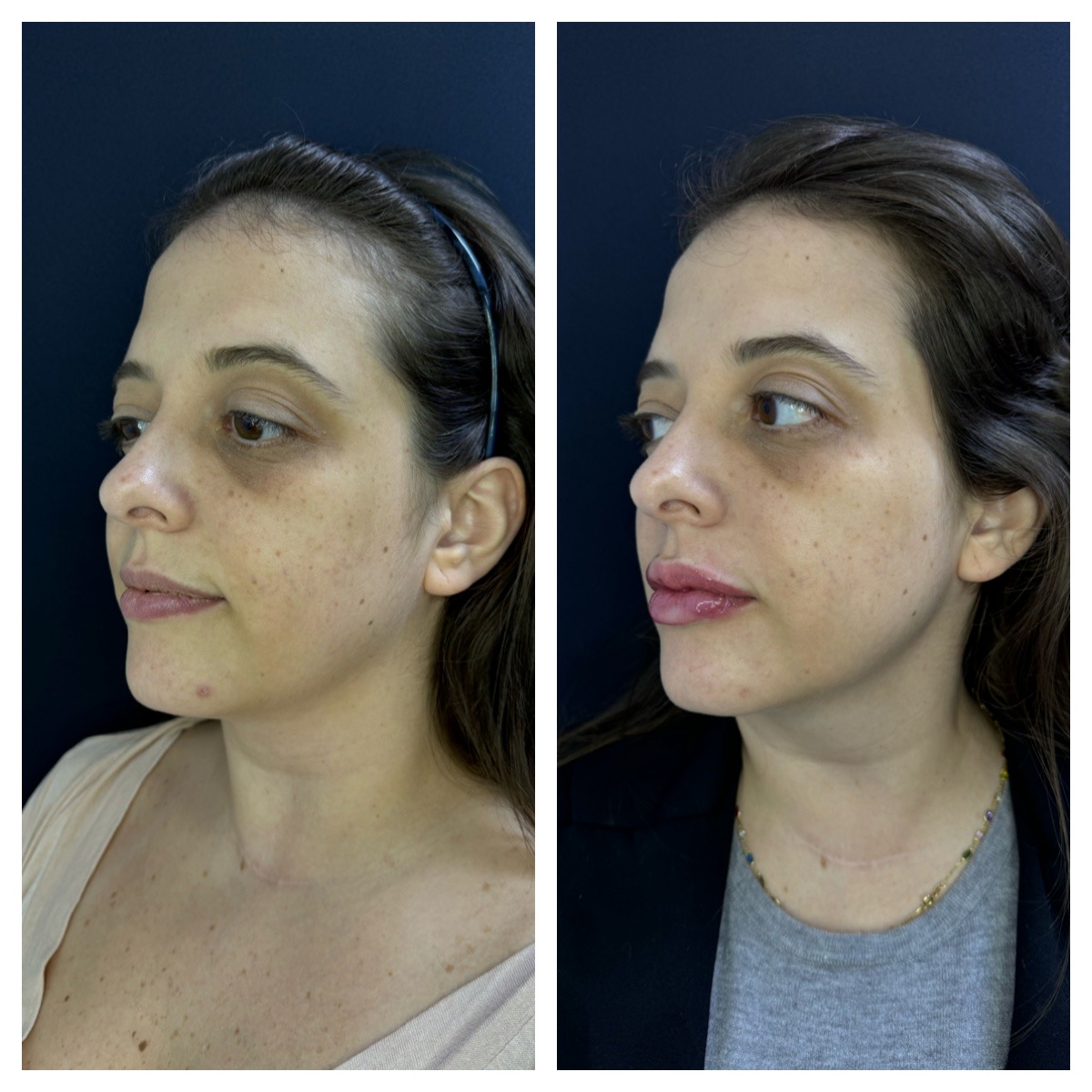 Processed with MOLDIV