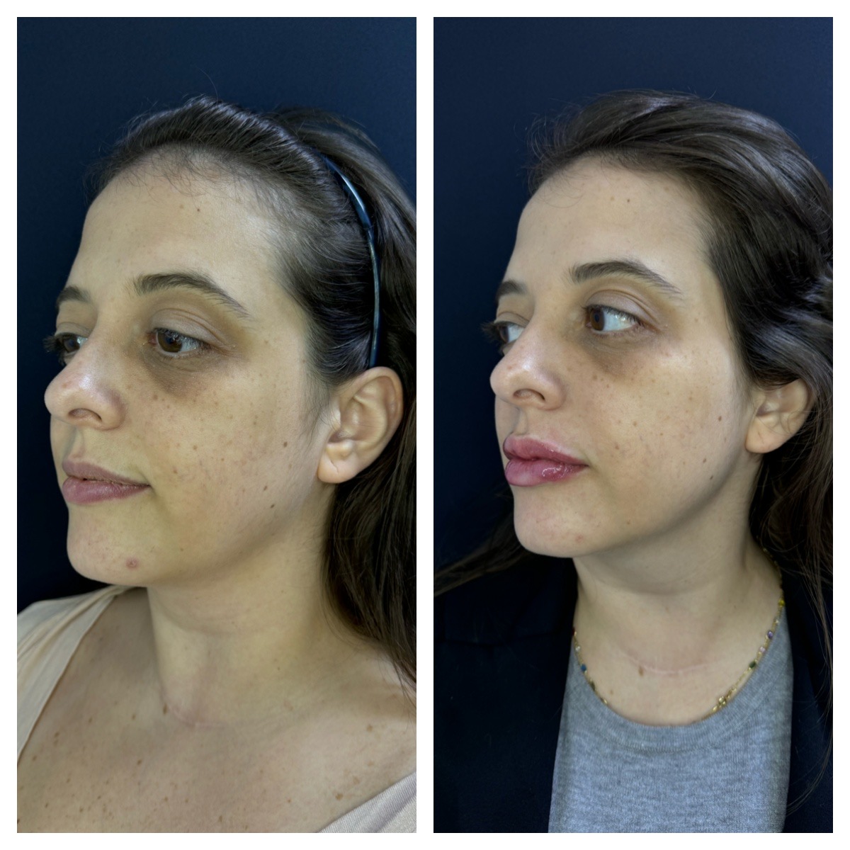 Processed with MOLDIV