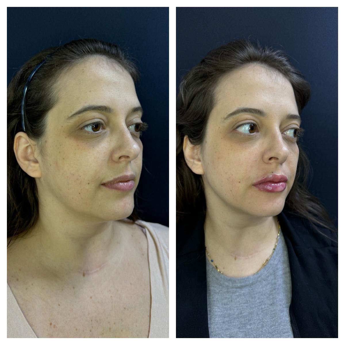 Processed with MOLDIV