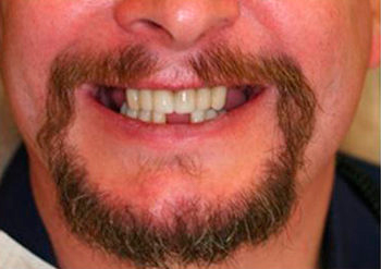 implant2.jpg